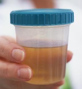 urine-cup